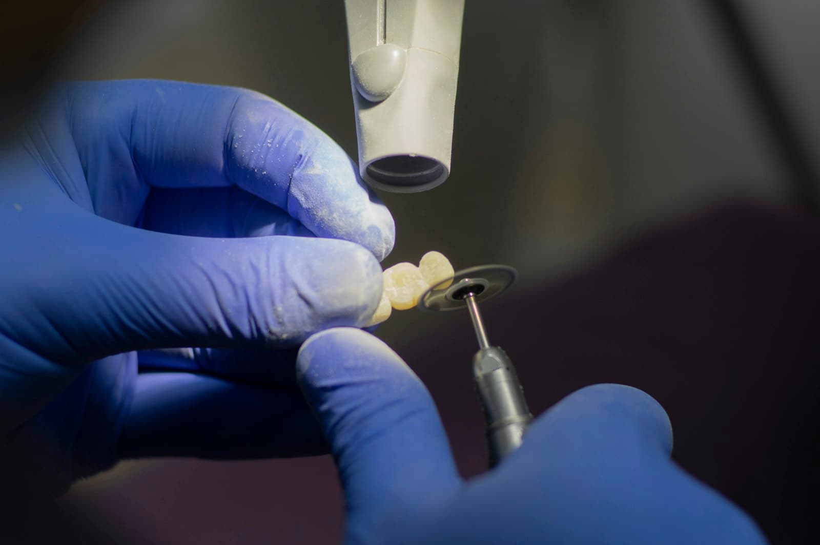 Root Canal