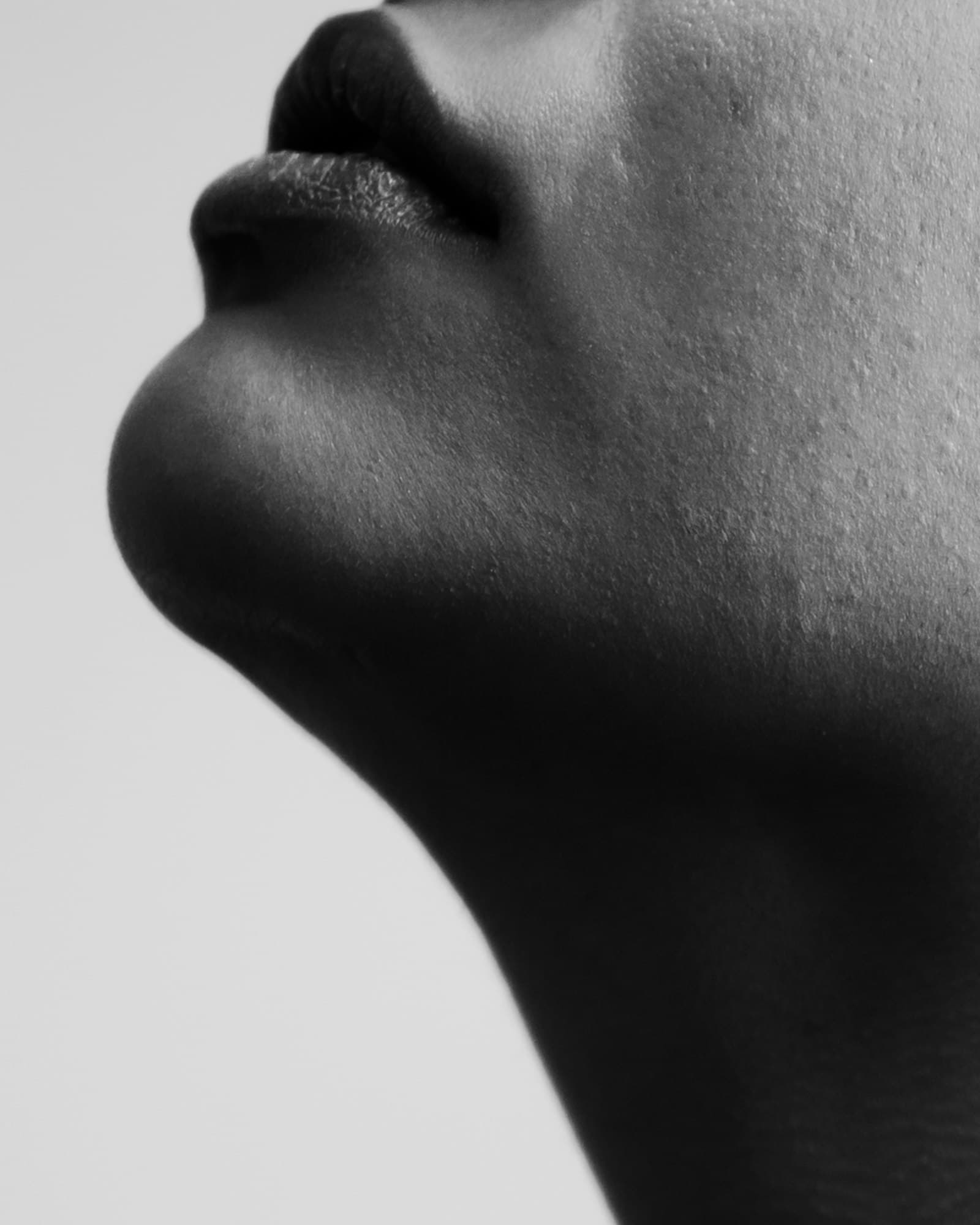 Threadlift